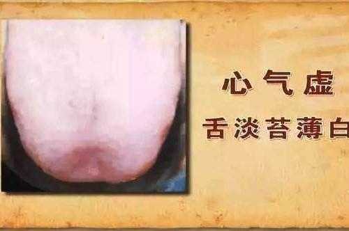 孕妇舌苔发白怎么办?是什么原因,孕期舌苔白厚口苦口臭怎么调理 第2张 孕妇舌苔发白怎么办?是什么原因,孕期舌苔白厚口苦口臭怎么调理 第2张