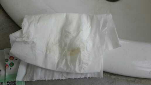 孕期灰色白带(孕期灰色白带) 第2张 孕期灰色白带(孕期灰色白带) 第2张