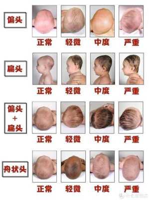 宝宝头骨发育过程,胎儿颅骨发育过程图 第3张 宝宝头骨发育过程,胎儿颅骨发育过程图 第3张