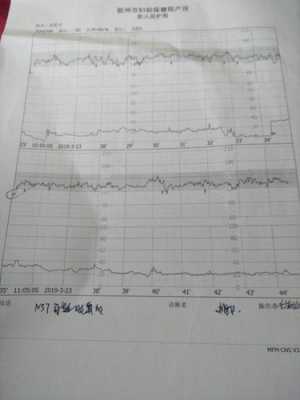 胎心监护基线偏低怎么回事,胎儿胎心偏低怎么办  第2张