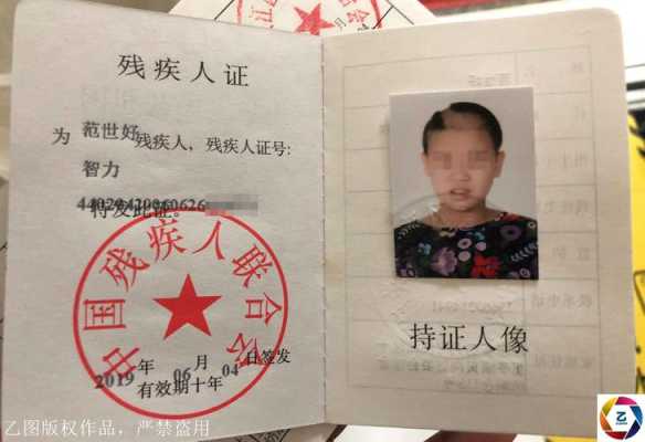 智障胎儿孕期特征(宝宝轻度弱智的表现是什么) 第2张 智障胎儿孕期特征(宝宝轻度弱智的表现是什么) 第2张
