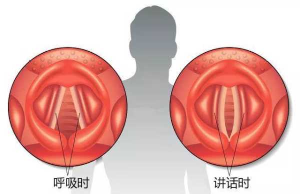 孕期喉咙沙哑(孕期喉咙沙哑疼痛怎么办) 第2张 孕期喉咙沙哑(孕期喉咙沙哑疼痛怎么办) 第2张