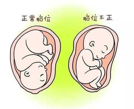 胎儿发动前有什么预兆，身体会有什么症状呢,胎儿发动的条件是什么  第2张