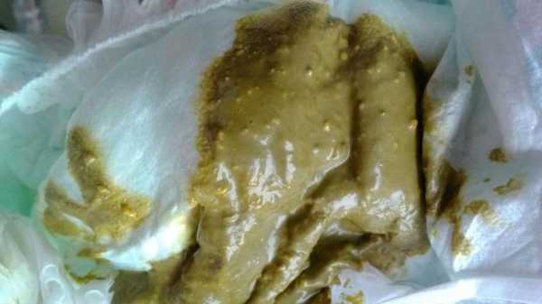 胎儿酸血症(月子里的宝宝拉绿屎而且有股酸臭味是怎么回事) 第2张 胎儿酸血症(月子里的宝宝拉绿屎而且有股酸臭味是怎么回事) 第2张