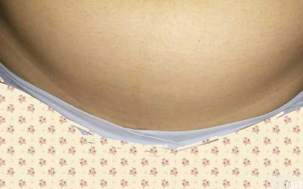 孕期妊娠线(为什么怀孕没有妊娠线啊) 第2张 孕期妊娠线(为什么怀孕没有妊娠线啊) 第2张