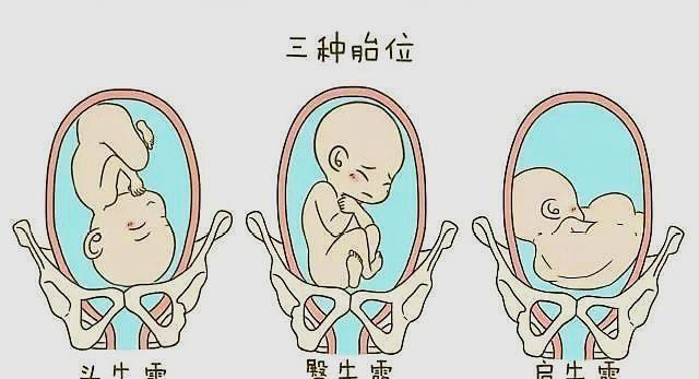 胎儿趴着的原因(胎儿趴着的原因有哪些) 第2张 胎儿趴着的原因(胎儿趴着的原因有哪些) 第2张