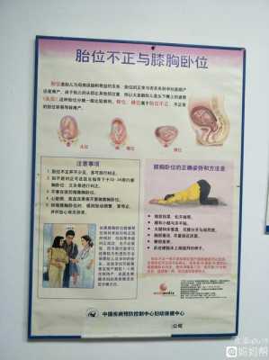 胎位是LSA怎么办,如何改变胎儿体位姿势 第2张 胎位是LSA怎么办,如何改变胎儿体位姿势 第2张