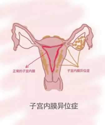 孕期积液增多(水量大的原因是什么) 第2张 孕期积液增多(水量大的原因是什么) 第2张