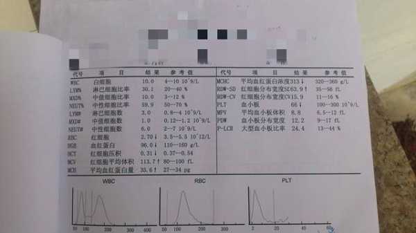 孕期积液增多(水量大的原因是什么) 第1张 孕期积液增多(水量大的原因是什么) 第1张