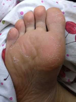 孕期脚出汗(孕期脚出汗多是什么原因怎么办) 第2张 孕期脚出汗(孕期脚出汗多是什么原因怎么办) 第2张