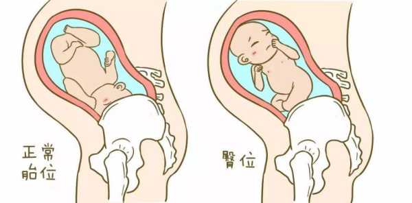胎儿偏向肚子左边(胎儿往左边肚子歪怎么办) 第2张 胎儿偏向肚子左边(胎儿往左边肚子歪怎么办) 第2张