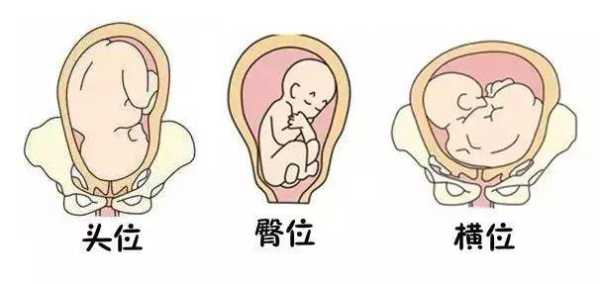 l和p哪个是左,胎儿头位lop是什么意思 第2张 l和p哪个是左,胎儿头位lop是什么意思 第2张