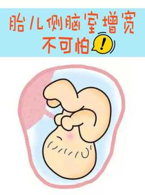 脑室增宽是什么意思。怎么治疗啊,胎儿脑部增宽是什么原因引起 第1张 脑室增宽是什么意思。怎么治疗啊,胎儿脑部增宽是什么原因引起 第1张