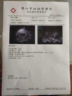 产检老公可以用献血证证明吗,男子用血喂养胎儿视频 第1张 产检老公可以用献血证证明吗,男子用血喂养胎儿视频 第1张