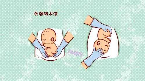 胎儿是怎么调整胎位的?需要专业调整,胎儿体位怎么调整图片 第2张 胎儿是怎么调整胎位的?需要专业调整,胎儿体位怎么调整图片 第2张