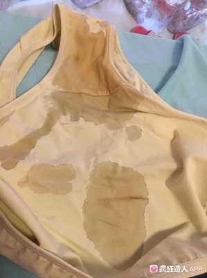 孕期漏羊水(漏羊水的症状) 第3张 孕期漏羊水(漏羊水的症状) 第3张
