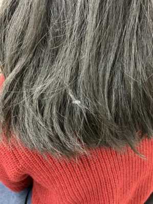 孕期不长头发（头发好象没有发根是为什么）  第2张
