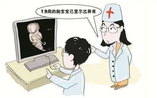 孕妇担心胎儿畸形弱智(孕妇担心胎儿畸形弱智怎么办) 第1张 孕妇担心胎儿畸形弱智(孕妇担心胎儿畸形弱智怎么办) 第1张