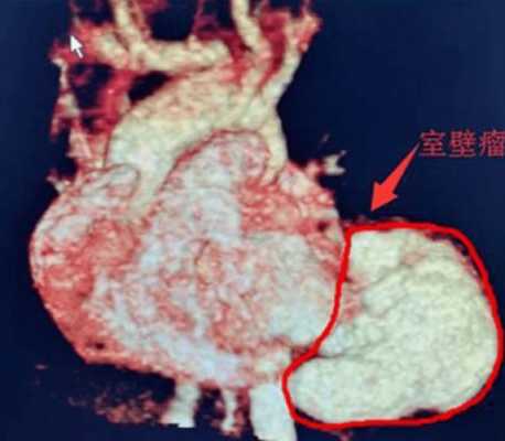 胎儿坏死有什么症状(胎儿坏死有什么症状吗) 第3张 胎儿坏死有什么症状(胎儿坏死有什么症状吗) 第3张