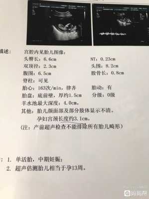13周胎儿nt图片(13周胎儿的nt标准值) 第2张 13周胎儿nt图片(13周胎儿的nt标准值) 第2张