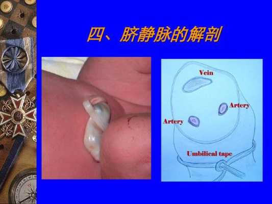 胎儿脐带内血管有(脐带是什么样的) 第1张 胎儿脐带内血管有(脐带是什么样的) 第1张