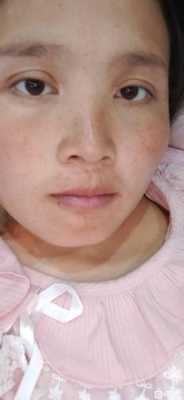 怀女儿会变丑吗,孕期变丑是男孩女孩 第3张 怀女儿会变丑吗,孕期变丑是男孩女孩 第3张