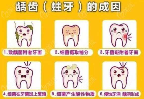 孕期容易蛀牙（孕期容易蛀牙的原因）  第2张