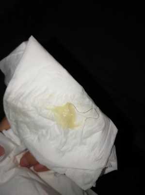 孕期白带很少(孕七个月,今天突然白带变少颜色变透明色了怎么回事) 第2张 孕期白带很少(孕七个月,今天突然白带变少颜色变透明色了怎么回事) 第2张