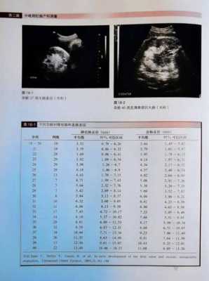 胎儿小肠内径发育标准(胎儿小肠内径发育标准是多少) 第1张 胎儿小肠内径发育标准(胎儿小肠内径发育标准是多少) 第1张