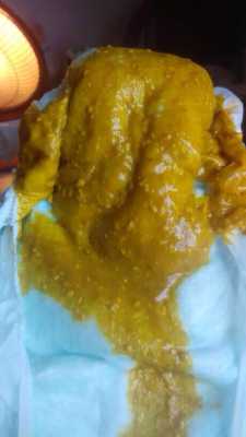 40多天的胎儿图片(40天的宝宝七八天不拉大便怎么回事) 第1张 40多天的胎儿图片(40天的宝宝七八天不拉大便怎么回事) 第1张