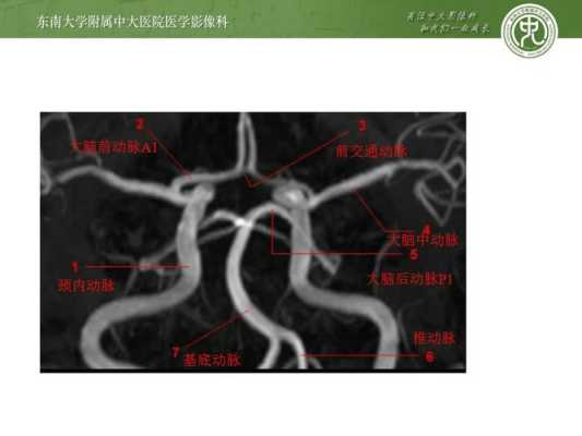 胎儿C型血管环(大脑willis环为什么叫willis环) 第2张 胎儿C型血管环(大脑willis环为什么叫willis环) 第2张