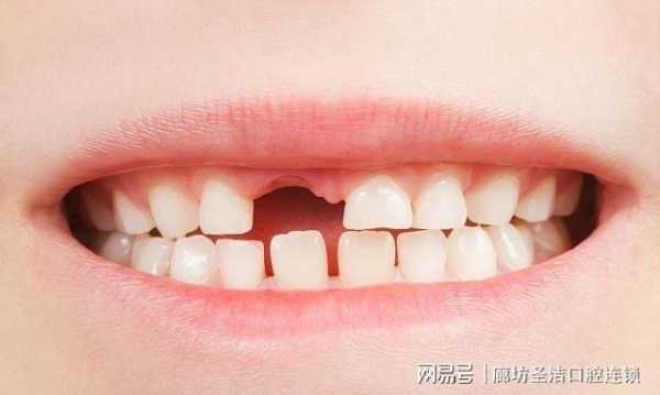 胎儿埋在哪比较合适(俗话说上牙掉了扔房顶,下牙掉了扔哪里) 第2张 胎儿埋在哪比较合适(俗话说上牙掉了扔房顶,下牙掉了扔哪里) 第2张