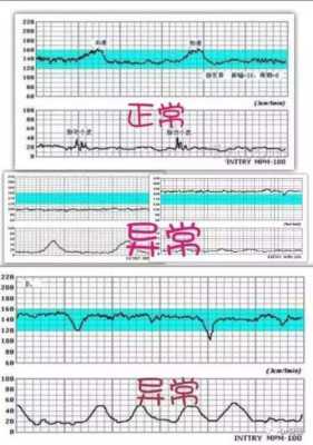 孕晚期胎儿心跳180（孕晚期胎儿心跳180危险吗）  第1张