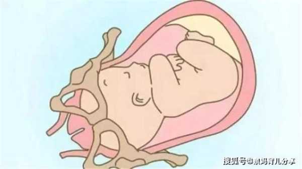 怎么感觉胎儿入盆(孩子入盆的症状) 第1张 怎么感觉胎儿入盆(孩子入盆的症状) 第1张