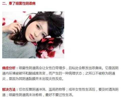 孕期阴道异味(阴道异味是怎么回事) 第1张 孕期阴道异味(阴道异味是怎么回事) 第1张