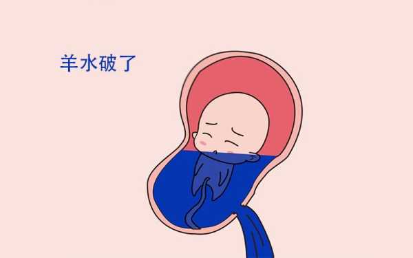 孕期羊水破了(孕期羊水破了会一直流吗) 第3张 孕期羊水破了(孕期羊水破了会一直流吗) 第3张
