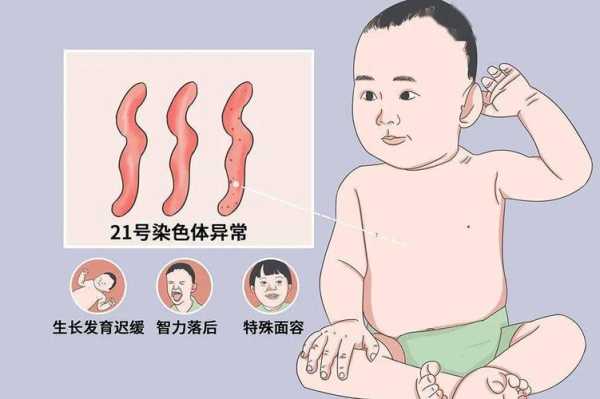怀孕怎么预防胎儿智障(夫妻正常为啥生几个孩子都是弱智) 第2张 怀孕怎么预防胎儿智障(夫妻正常为啥生几个孩子都是弱智) 第2张