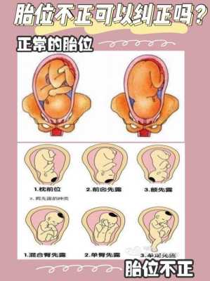 胎儿枕左前位图片(胎儿枕左前位的图片) 第3张 胎儿枕左前位图片(胎儿枕左前位的图片) 第3张