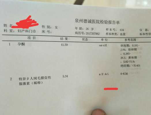 孕期抽血好吗(孕期抽血好吗有影响吗) 第1张 孕期抽血好吗(孕期抽血好吗有影响吗) 第1张