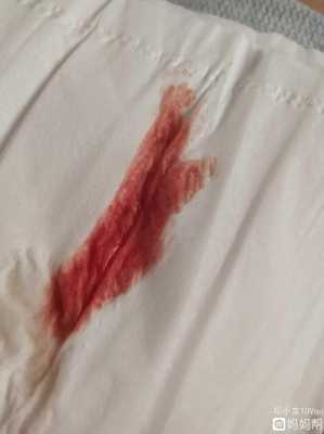 孕妇见红是什么颜色,孕期出血时间长容易感染吗 第1张 孕妇见红是什么颜色,孕期出血时间长容易感染吗 第1张