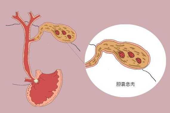 胎儿胆囊小怎么补救(胎儿胆囊小怎么补救好) 第2张 胎儿胆囊小怎么补救(胎儿胆囊小怎么补救好) 第2张