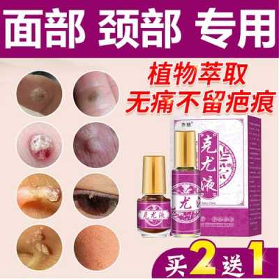 猴子怀胎多久,孕期长瘊子是怎么回事 第3张 猴子怀胎多久,孕期长瘊子是怎么回事 第3张
