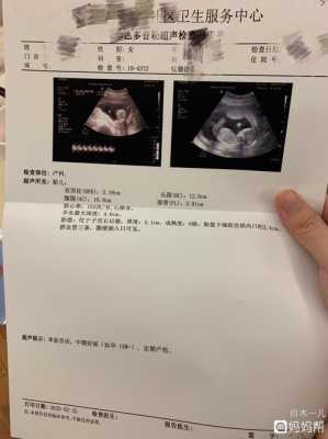112天的宝宝应该多少斤,怀孕112天胎儿图片 第3张 112天的宝宝应该多少斤,怀孕112天胎儿图片 第3张