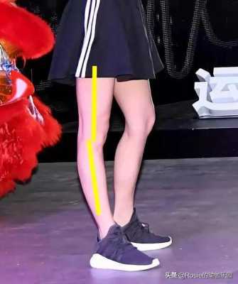 孕期腿变粗(两个月的宝宝大腿粗小腿细什么原因呢) 第2张 孕期腿变粗(两个月的宝宝大腿粗小腿细什么原因呢) 第2张