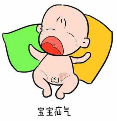 孕期腹股沟疝(儿童腹股沟疝气) 第1张 孕期腹股沟疝(儿童腹股沟疝气) 第1张