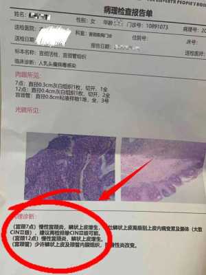 孕期宫颈增生(宫颈鳞状上皮增生怎么治疗) 第2张 孕期宫颈增生(宫颈鳞状上皮增生怎么治疗) 第2张