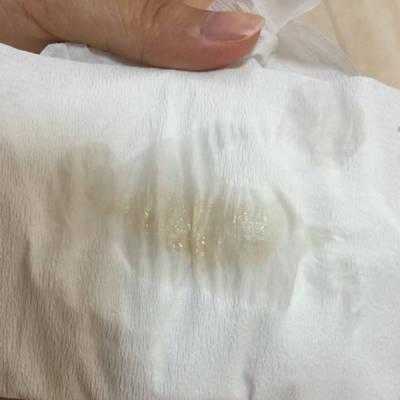 孕期白带恶臭(孕期白带恶臭) 第2张 孕期白带恶臭(孕期白带恶臭) 第2张