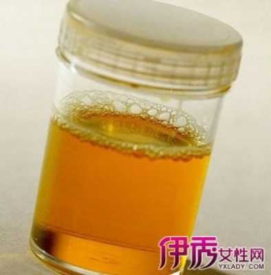 孕期尿液偏黄(孕期尿液偏黄正常吗) 第3张 孕期尿液偏黄(孕期尿液偏黄正常吗) 第3张