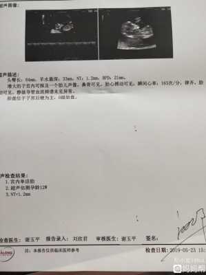 孕12周胎心167次正常吗,胎儿心跳167正常吗 第2张 孕12周胎心167次正常吗,胎儿心跳167正常吗 第2张