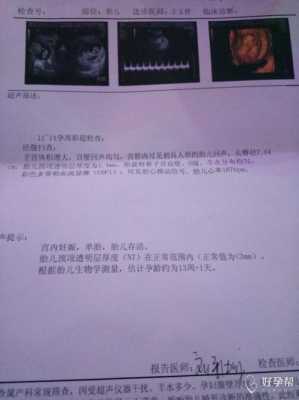 孕12周胎心167次正常吗,胎儿心跳167正常吗 第1张 孕12周胎心167次正常吗,胎儿心跳167正常吗 第1张